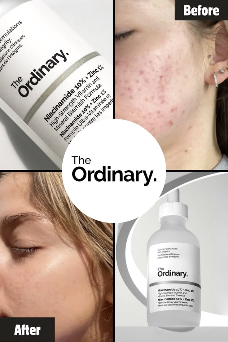 The Ordinary Niacinamide Serum