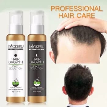 HAIR GROWTH CARE SOLUTION